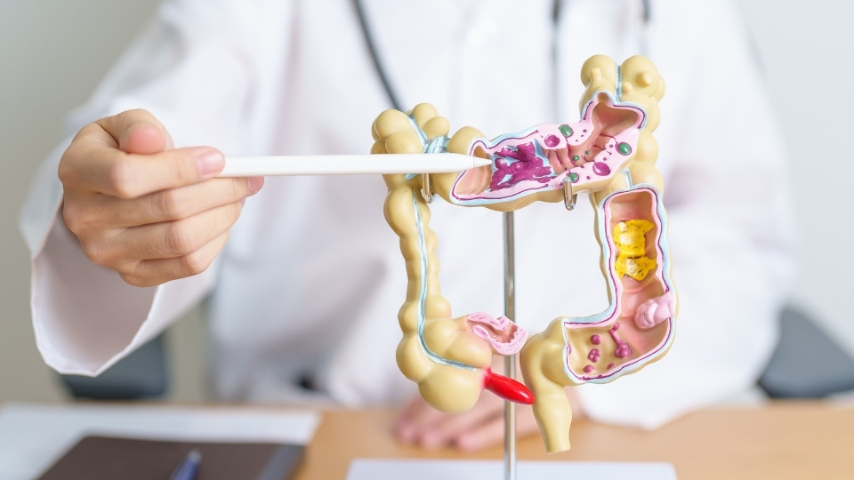 Registered Dietitian pointing at a model of the human colon, demonstrating parts of the digestive system, including areas with potential blockages.