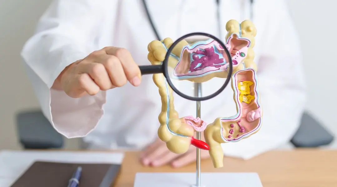 a doctor holding a magnifying glass over a model of the human digestive system