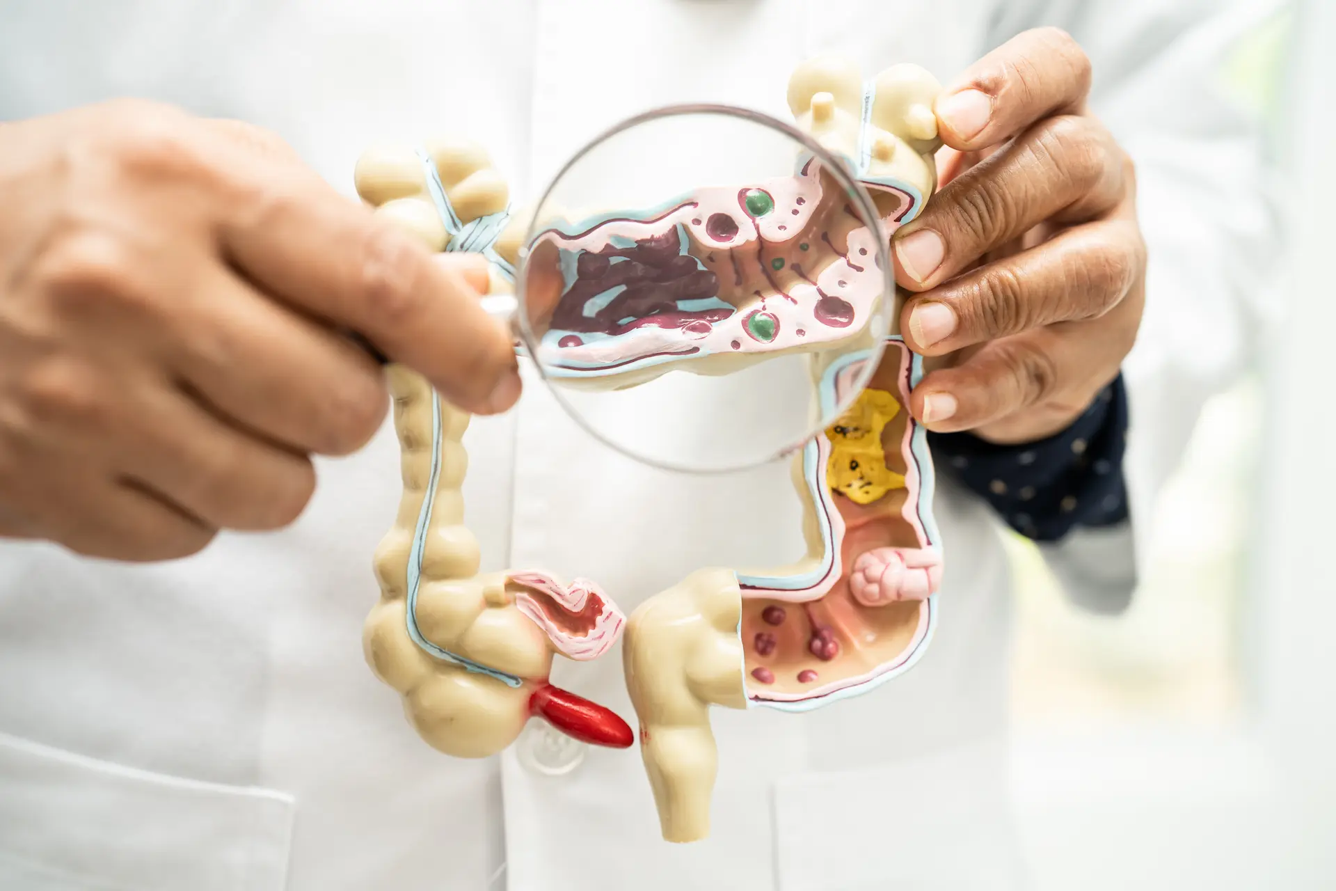 Médecin tenant une maquette du côlon avec loupe - Doctor holding a colon model with magnifying glass