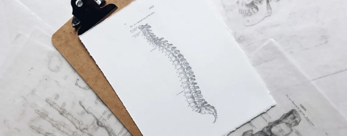 Lower Back Sprain