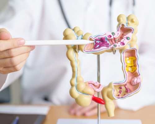 Registered Dietitian pointing at a model of the human colon, demonstrating parts of the digestive system, including areas with potential blockages.