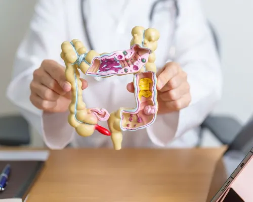 A person in a white coat holds up a model of the large intestine, showing its internal structure with different colored sections representing healthy and unhealthy tissue.