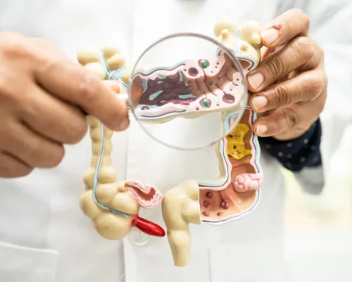 Médecin tenant une maquette du côlon avec loupe - Doctor holding a colon model with magnifying glass