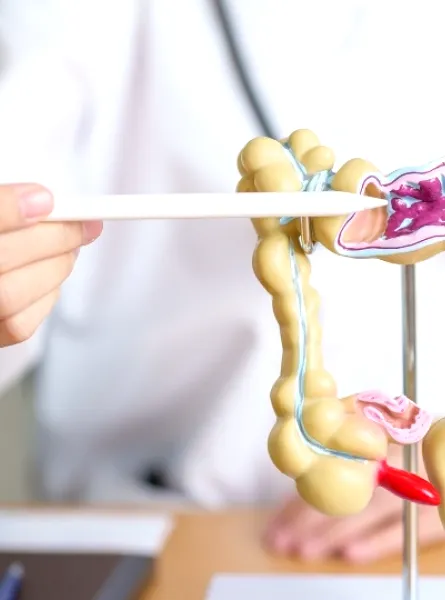 Registered Dietitian pointing at a model of the human colon, demonstrating parts of the digestive system, including areas with potential blockages.