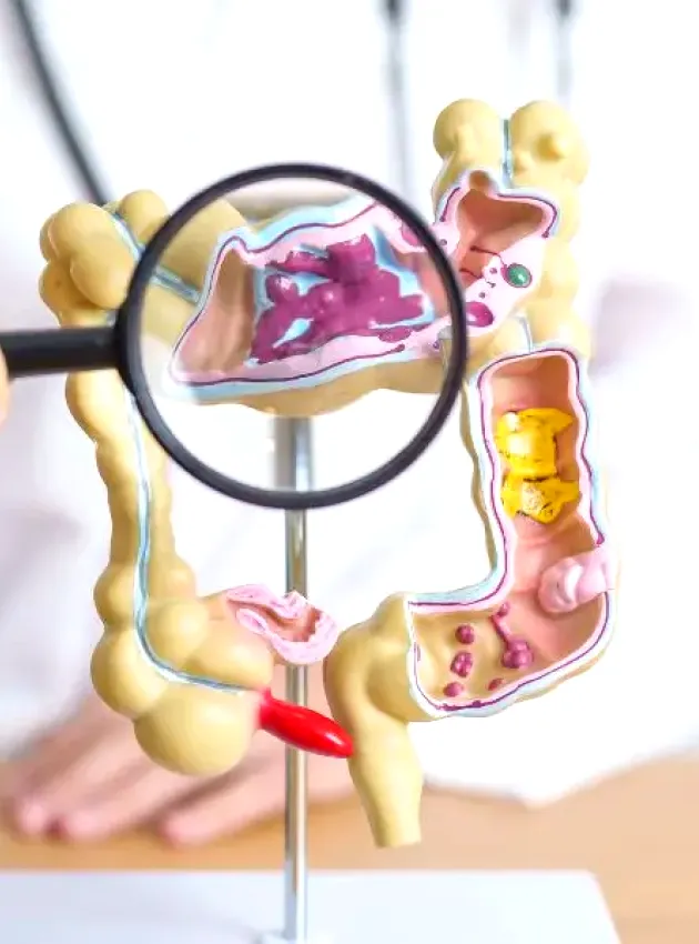 a doctor holding a magnifying glass over a model of the human digestive system
