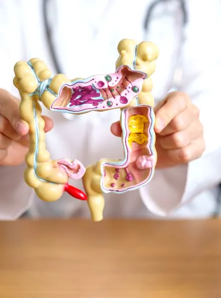 A person in a white coat holds up a model of the large intestine, showing its internal structure with different colored sections representing healthy and unhealthy tissue.